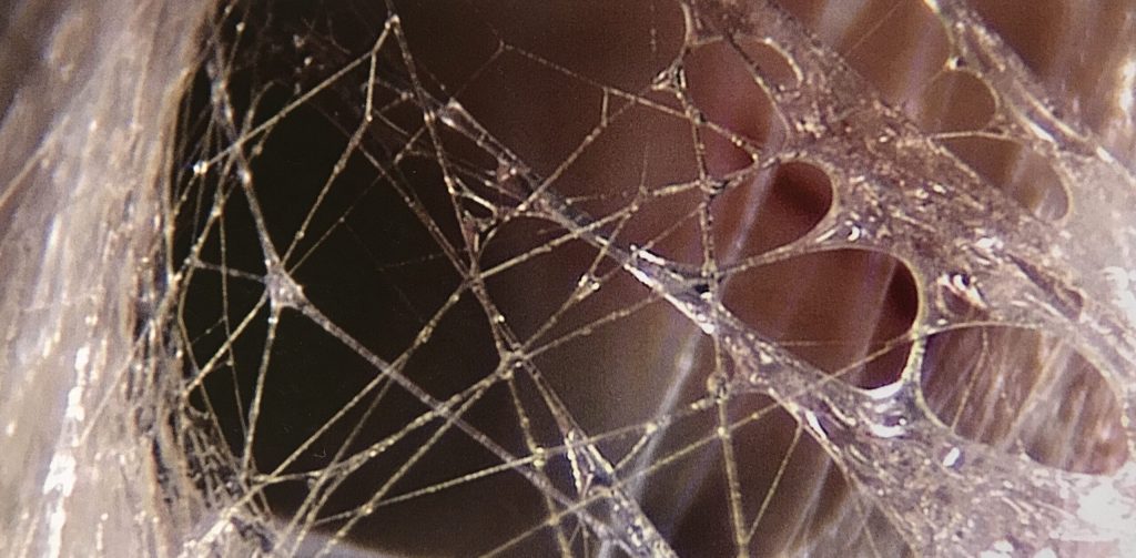 Close-up of fascial collagen tissue — a translucent web of connective tissue